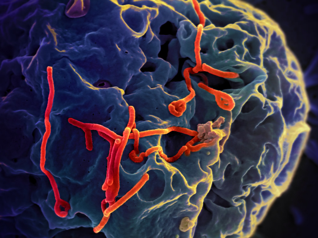 Is Ebola the Next HIV/AIDS Pandemic?